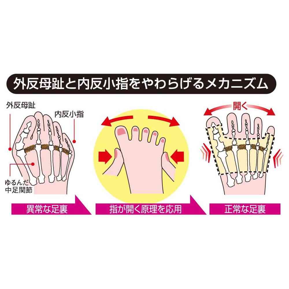 アルファックス 外反母趾・内反小指サポーター S左足用 - Image 3
