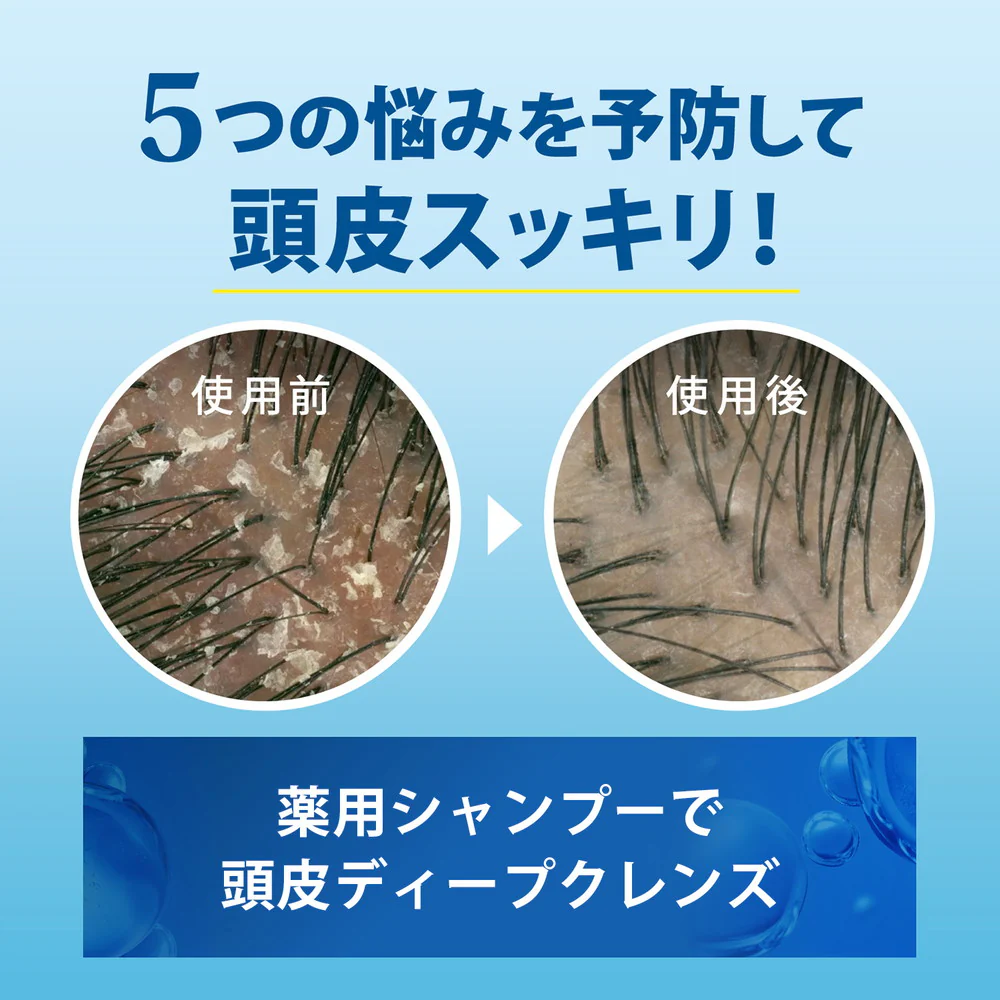 【医薬部外品】h＆s（エイチアンドエス）5in1マイルドモイスチャーシャンプー詰め替え  290g - Image 6