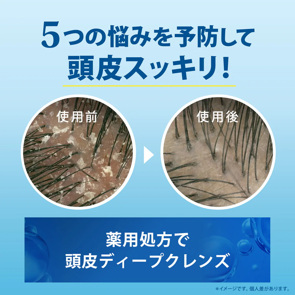 【医薬部外品】h＆s（エイチアンドエス）5in1コンディショナーポンプ  340g - Image 6